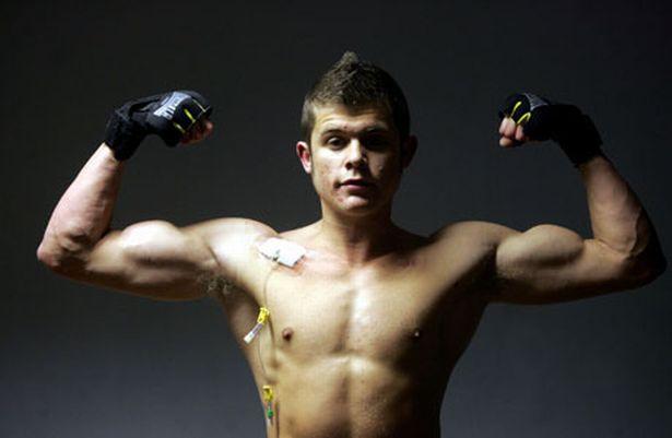 Jonny Simpson