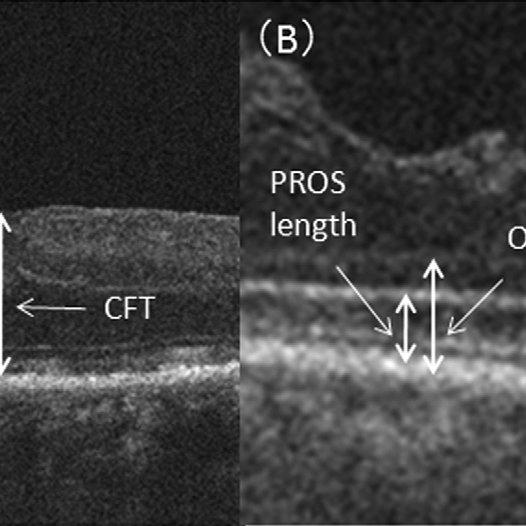 Itsuka (世界の終わり＆ゆず いつか)