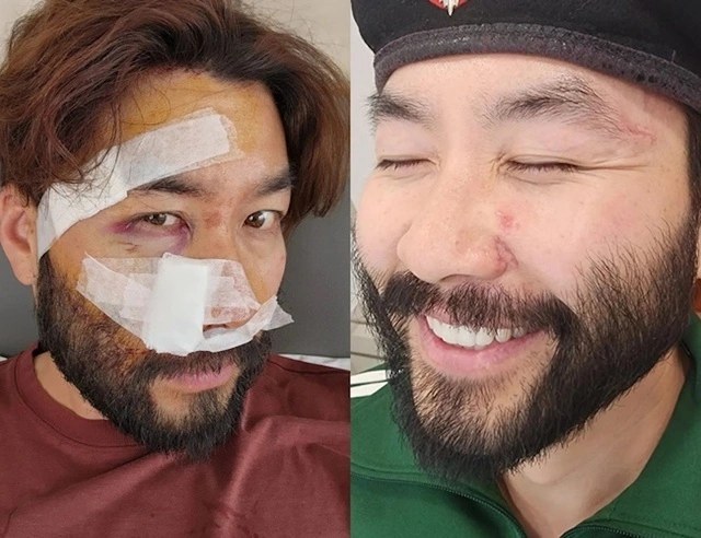 No Hong Chul