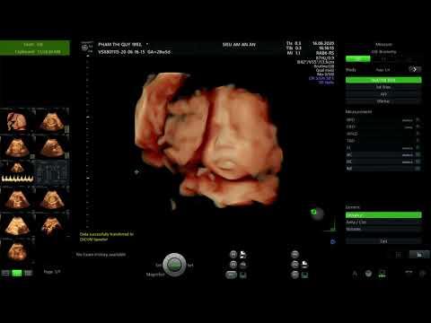 Ngộ Nhận (Trời sáng rồi, ta ngủ đi thôi ost)