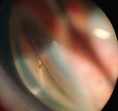 Kẻ cô đơn trong thành phố