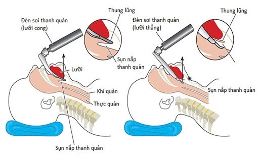 Tâm sự chàng ca sĩ