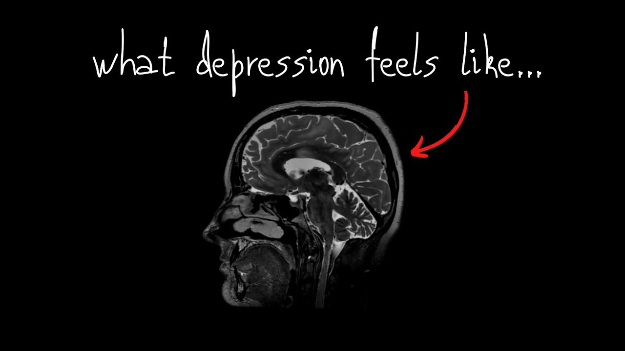 This is what depression feels like